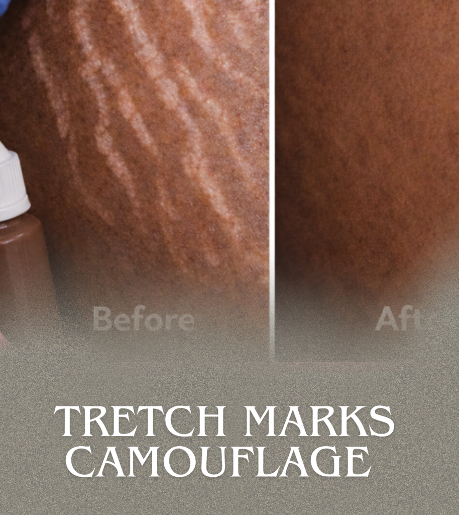 Scar & Stretch Mark Camouflage
