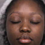 Saline Brow Correction