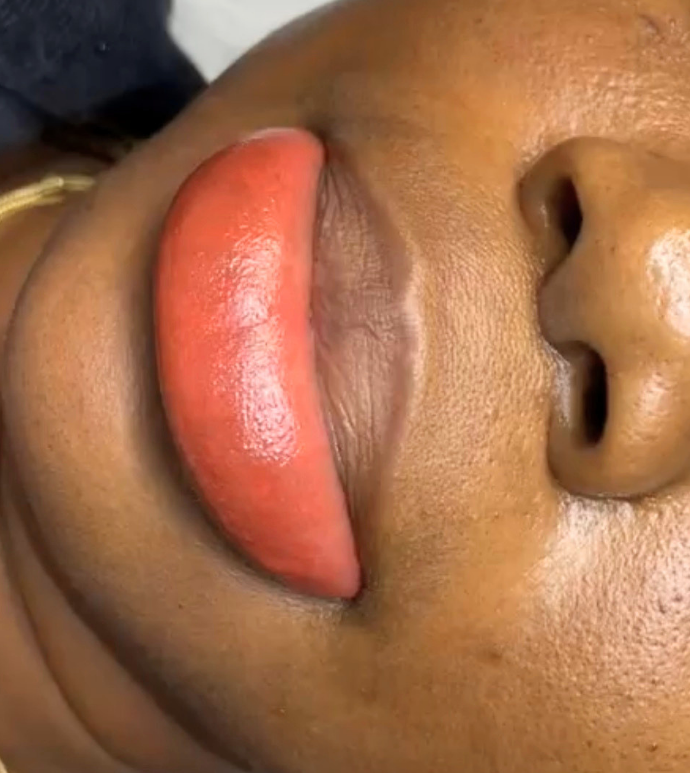lip neutralization 