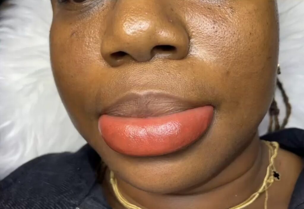 Pmu Lip Neutralization 